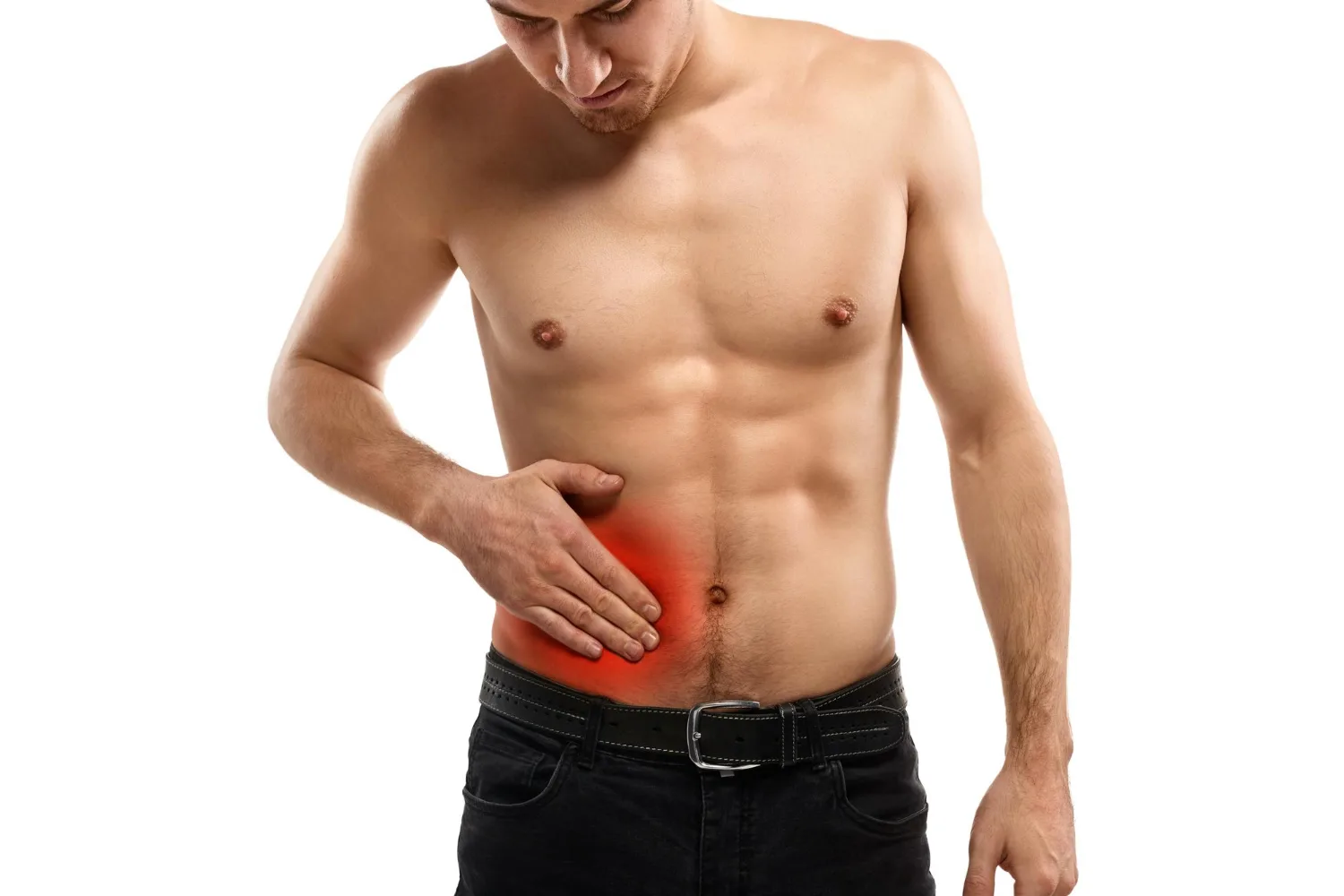 Hernia abdominal
